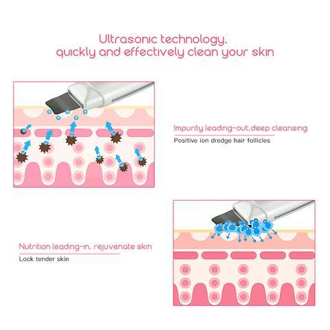 Ultrasonic Skin Scrubber & Face Cleanser | Blackhead Acne Removal Facial Spa Tool